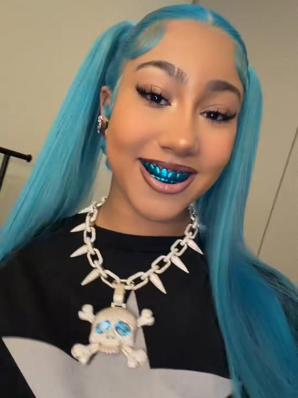 La niña de 12 años tiene una colección cada vez mayor de parrillas dentales, incluyendo este conjunto azul dorado brillante.Instagram/@northwsst