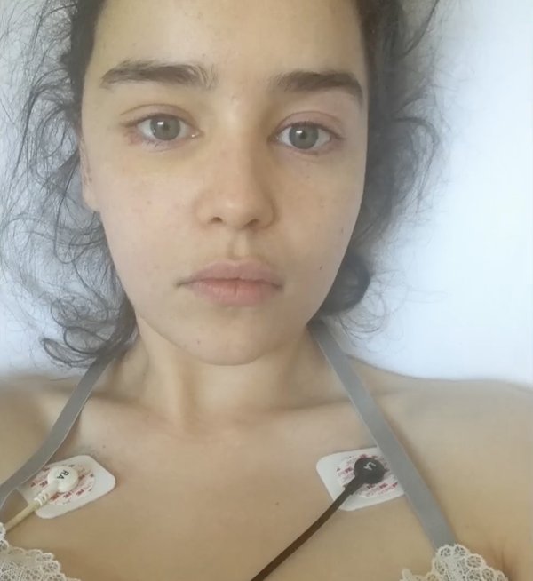 Tras sentir que había "escapado de la muerte", Clarke no podía "mirar a nadie a los ojos".