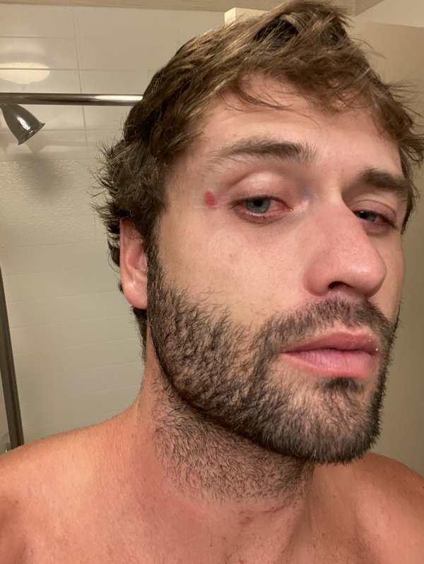 Paul criticó duramente a Mortensen (a quien se ve en la foto de arriba, mostrando las supuestas lesiones que le infligió Paul) por haber llamado a la policía y por intentar arrebatarle a su hijo, Ever.Departamento de Policía de Draper