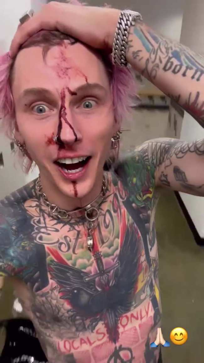 Machine Gun Kelly compartio nuevos clips de su cara chorreando sangre despues de romperse una copa de vino en la cabeza en el escenario de Cleveland