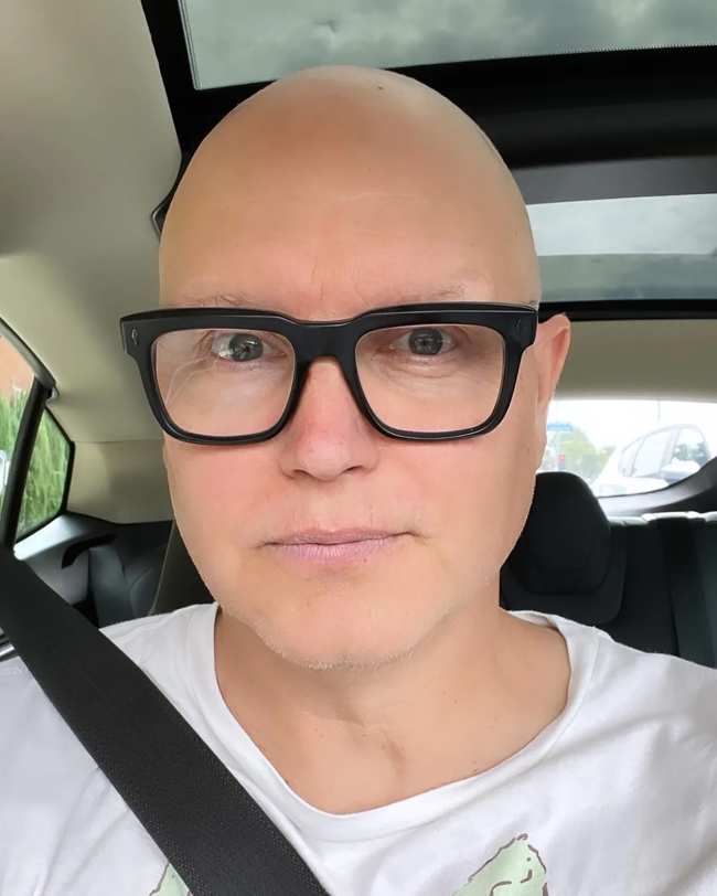 Mark perdio todo su cabello cuando estaba en quimioterapia