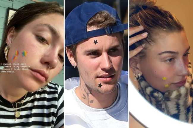 Florence Pugh y Justin y Hailey Bieber todos con pegatinas en forma de estrella sobre su acne