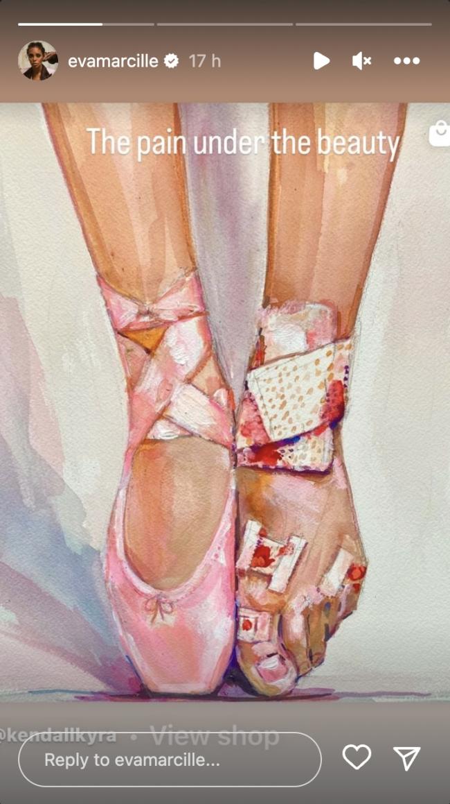 La estrella de reality publico una pintura criptica que muestra a una bailarina con un zapato de punta en un pie con el otro cubierto de sangre y vendajes