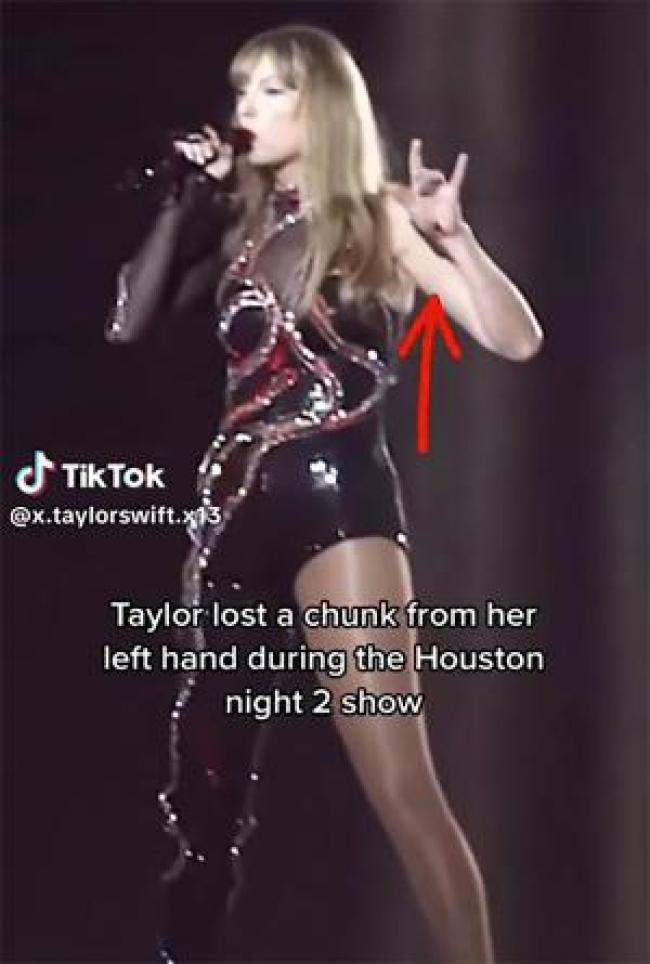 Taylor Swift cantando en el escenario con un corte en la mano
