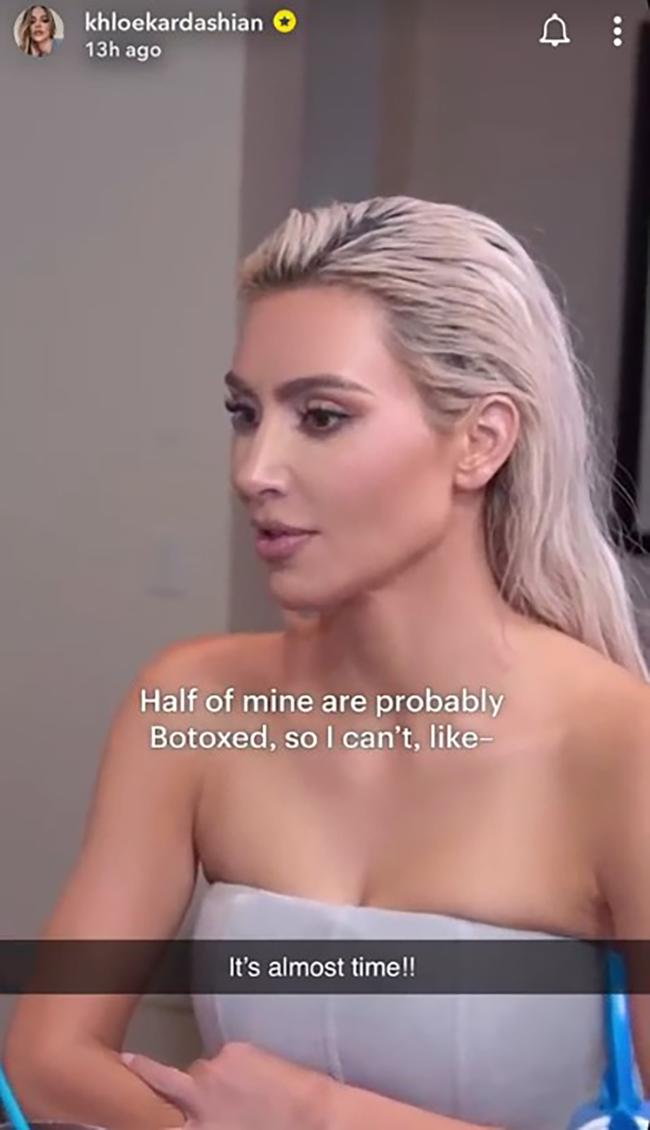 Kim Kardashian admitió haberse puesto Botox en el cuello, lo que le impedía cantar.