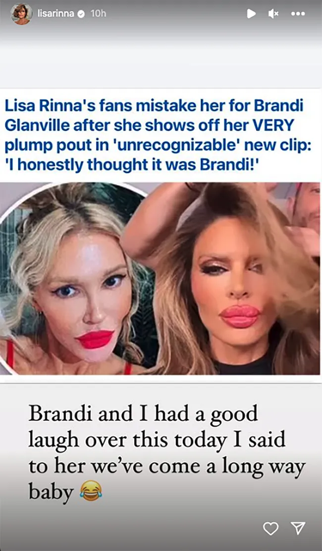 Lisa Rinna reaccionó a las comparaciones entre ella y Brandi Glanville.