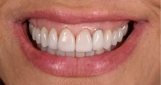 El famoso dentista nos dice que era hora de que la sonrisa de Fessler (en la foto antes del cambio de imagen) se 