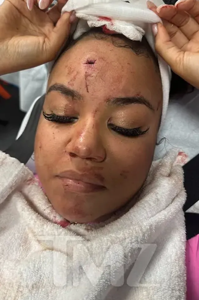 El incidente dejó a la locutora de radio Bryhana Monegain con una herida en la cabeza.