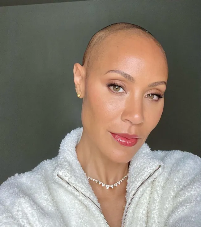 Pinkett Smith anunció públicamente que le diagnosticaron alopecia en 2018.