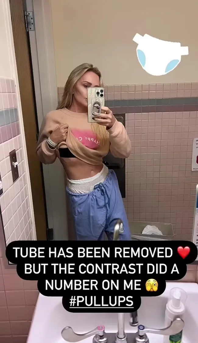 La estrella de “Real Housewives of Orange County” explicó que usaron un tubo para evitar la cirugía.