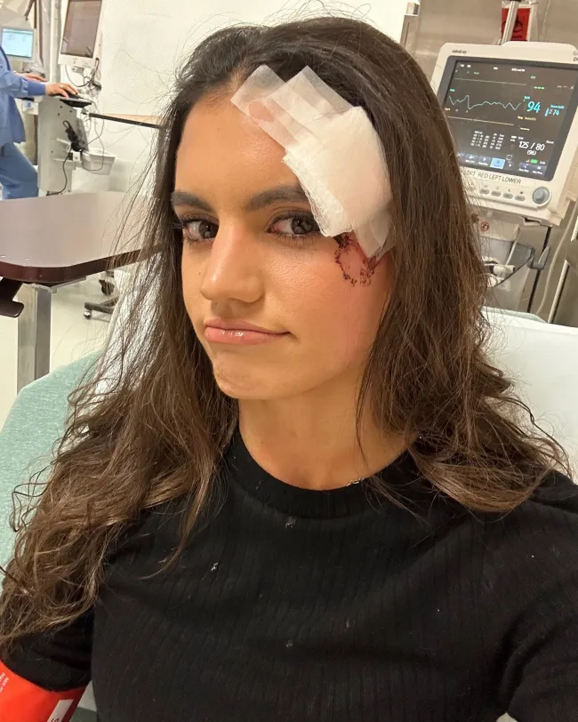 Hayley Erbert con lesión en la cabeza en el hospital