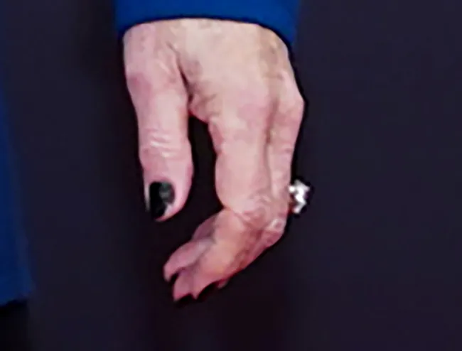La mujer de 68 años insistió en que simplemente “encontró” el anillo y decidió ponérselo.Tyler Golden/NBC