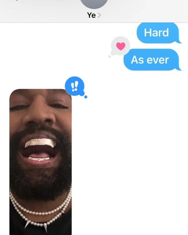 Kanye West sonriendo dientes de titanio