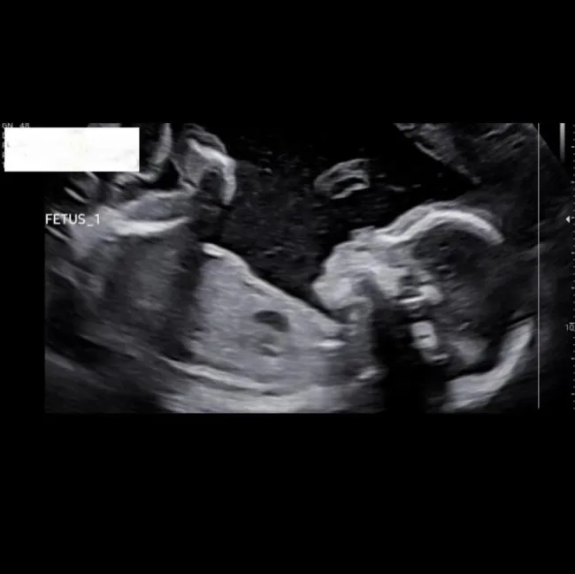 Kailyn Lowry muestra su panza mientras está embarazada de gemelos