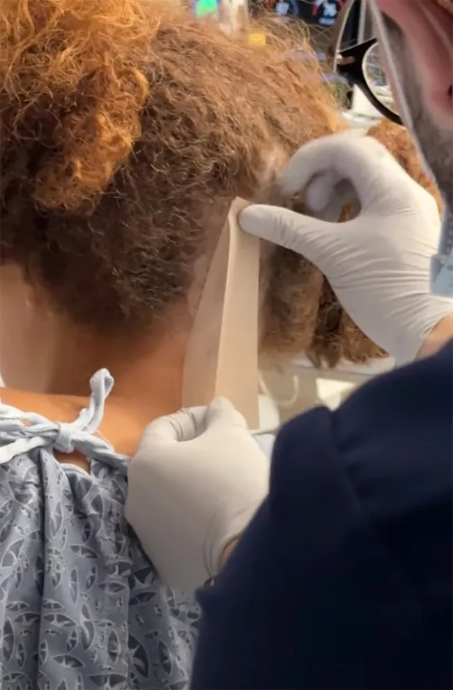 Un médico poniendo cinta adhesiva en la parte posterior de la cabeza de una mujer.