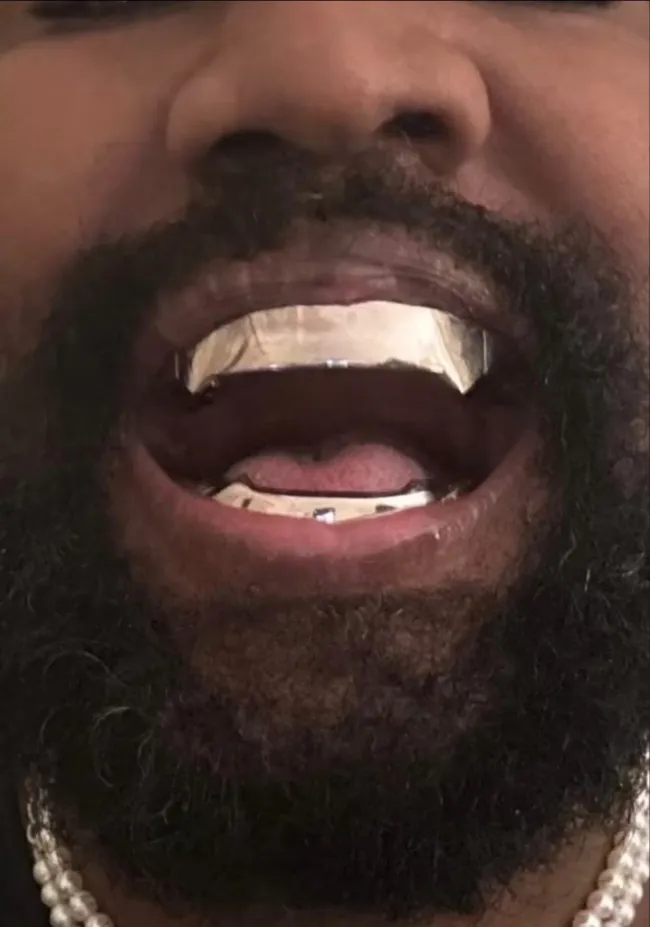 Primer plano de los dientes de metal de Kanye West.