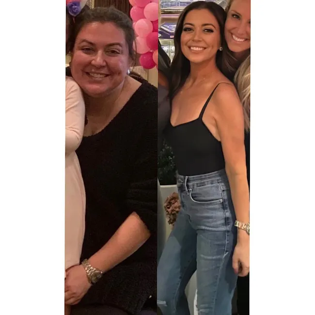 Una foto de lado a lado de Lauren Manzo antes y después de su pérdida de peso